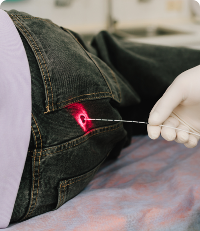 Biopsy