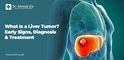 Liver Tumor Diagnosis & Treatment