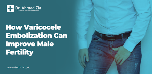 Varicocele Embolization to Improve Male Fertility