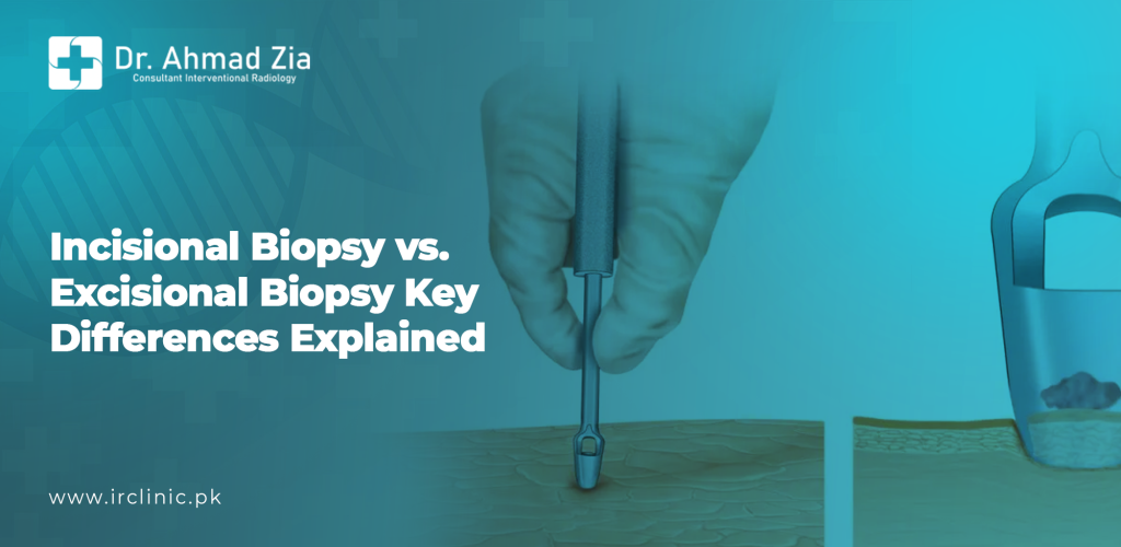 incisional biopsy vs. excisional biopsy
